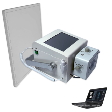 100ma normal frequency x-ray equipment chest x ray machine with cr x ray system